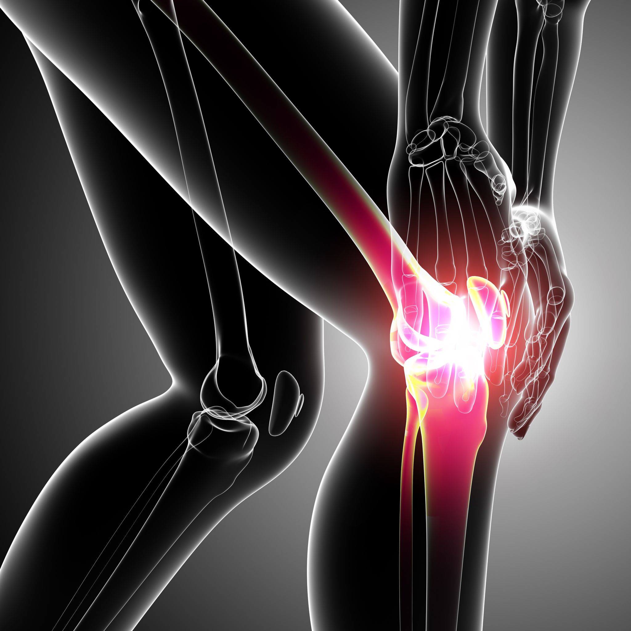 How to Find the Best Knee Pain Treatment in Tarpon Springs, FL