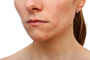When to Consider Visiting a St. Petersburg Dermatology Location