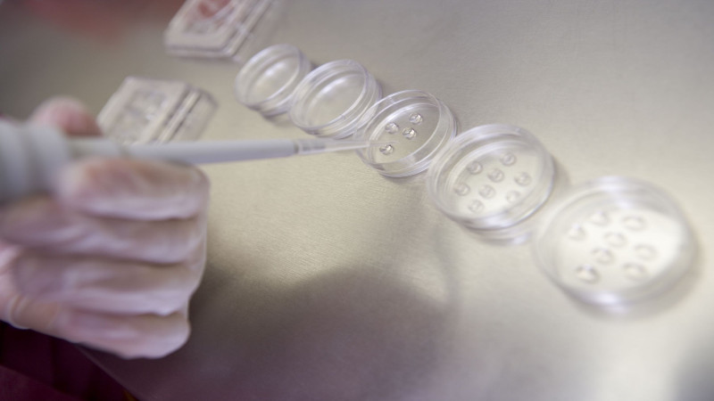 How to Select a Fertility Treatment Clinic in California