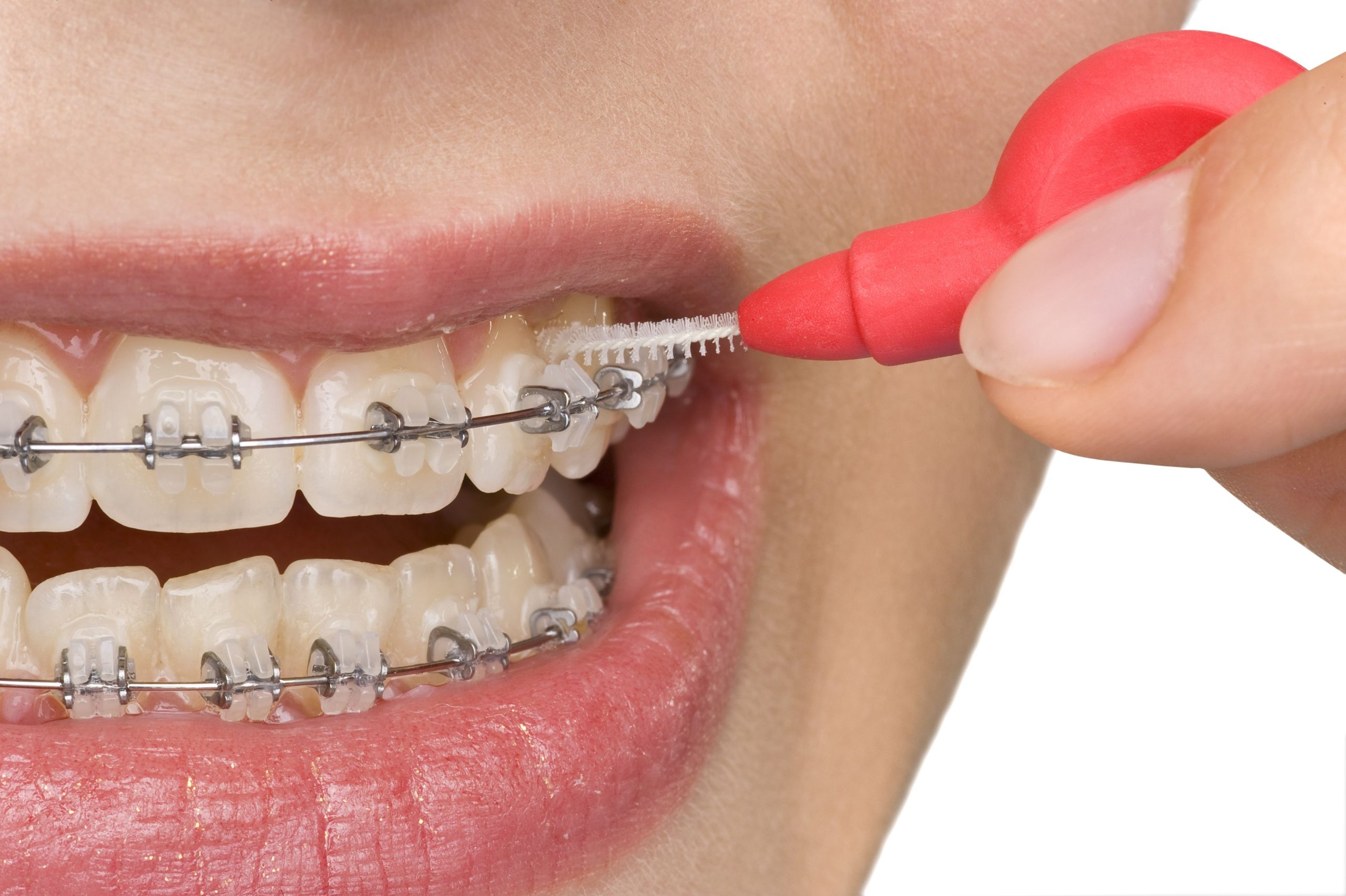 Dentists Who Specialize in Orthodontics in Kennewick Know Exactly What They’re Doing