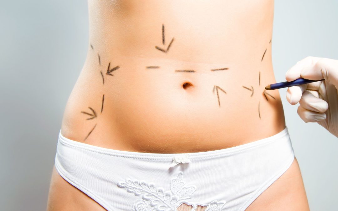 Reclaiming Confidence with a Mommy Makeover Hinsdale Patients Share Their Stories