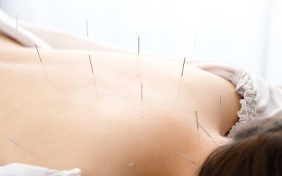 Experience natural relief with acupuncture for depression in Sherman Oaks CA and improve your well-being